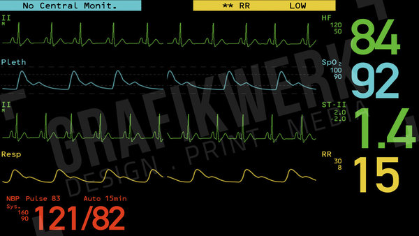 Computeranimation EKG (PC / Mac) (WSS006)