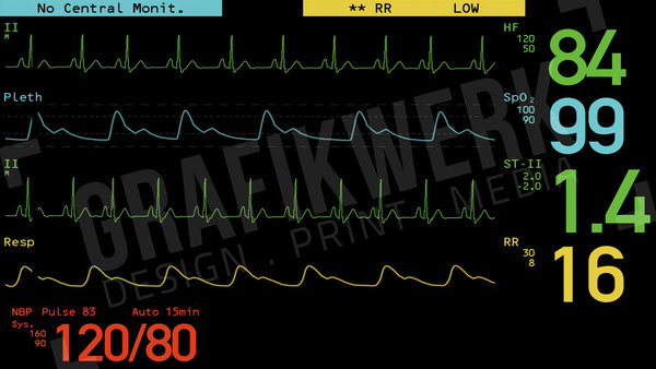 Computeranimation EKG (PC / Mac) (WSS006)